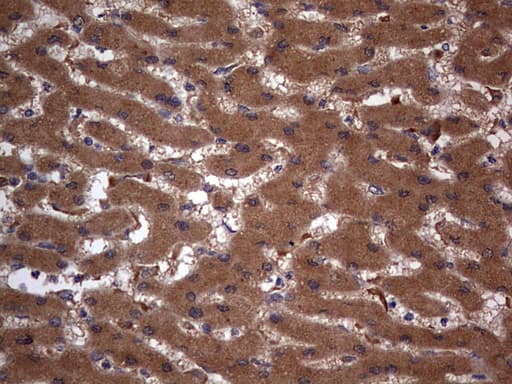 Monoclonal Mouse anti-Human ARAF / ARAF1 / A-RAF Antibody (clone OTI2G9, aa145-365, IHC, WB)