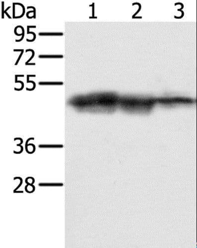 Polyclonal Rabbit anti-Human SMARCB1 / INI1 Antibody (IHC, WB)