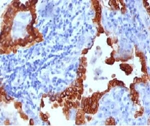 KRT8 / CK8 / Cytokeratin 8 Antibody (clone CYKN8-1)