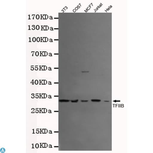 Monoclonal Mouse anti-Human TFIIB Antibody (WB)