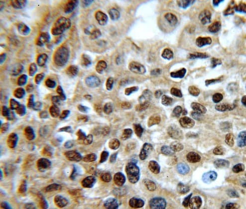 CDK1 / CDC2 Antibody