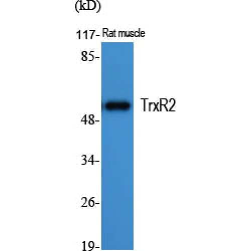 TXNRD2 Antibody (440-520 aa, C-terminal)