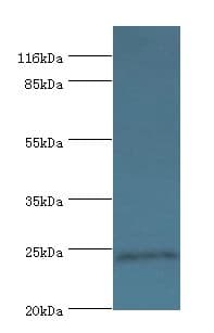 DUSP26 / MKP8 Antibody (aa1-211, HRP)