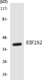EIF2S2 Antibody (aa53-102)