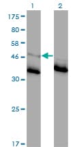 GLRA1/Glycine Receptor Alpha 1 Antibody (clone 2E6)