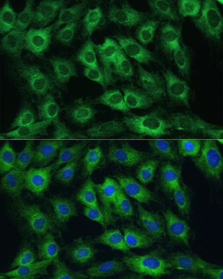 Polyclonal Rabbit anti-Human FRMD6 Antibody (IHC, IF)