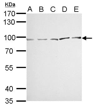 PathPlus™ MVP / VAULT1 Antibody (aa158-380)