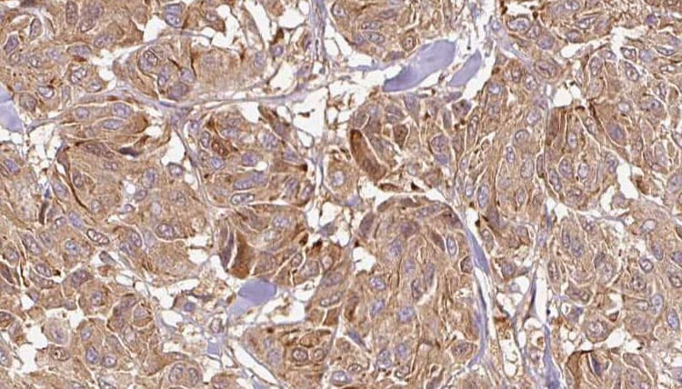 Polyclonal Rabbit anti-Human IL12A / p35 Antibody (IHC, WB)