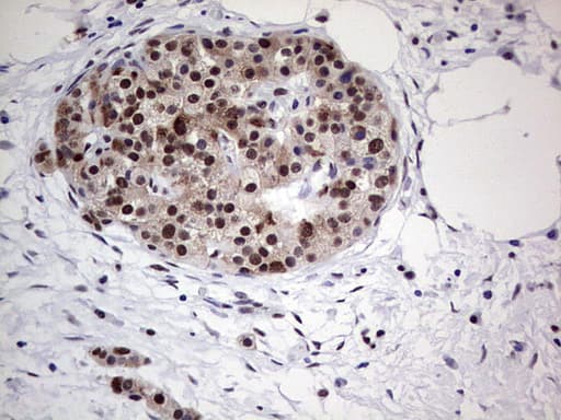 PPP1R8 / Rnase E Antibody (aa1-225, clone OTI4D5)