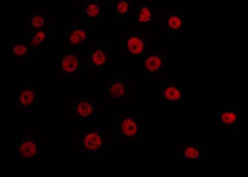 Polyclonal Rabbit anti-Human TBX3 Antibody (IF, WB)