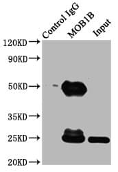 Polyclonal Rabbit anti-Human MOB1B / MOBKL1A Antibody (aa2-216, WB)