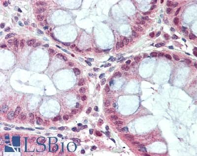 IHC-plus™ Polyclonal Rabbit anti-Human OPRS1 / SIGMAR1 Antibody (IHC, WB)