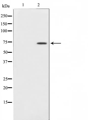 COL13A1 / Collagen XIII Antibody