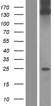 Human COL1A1 / Collagen I Alpha 1 Protein (Over-Expression Lysate Myc-DDK (Flag))