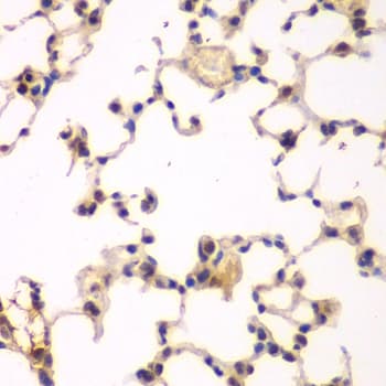 Polyclonal Rabbit anti-Human NFKBIB / IKB Beta / IKBB Antibody (IHC, IF, WB)