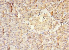 MS / MTR Antibody