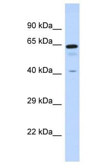 Polyclonal Rabbit anti-Human ZNF74 Antibody (aa20-69, WB)