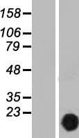 CUTA Protein (Over-Expression Lysate Myc-DDK (Flag))