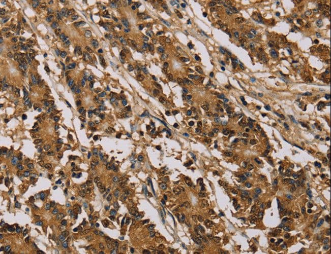 Polyclonal Rabbit anti-Human PSMC2 / RPT1 Antibody (IHC, WB)