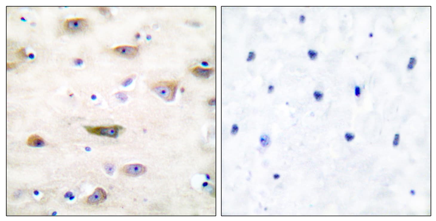 Polyclonal Rabbit anti-Human GRIA2 / GLUR2 Antibody (aa834-883, IHC, WB)