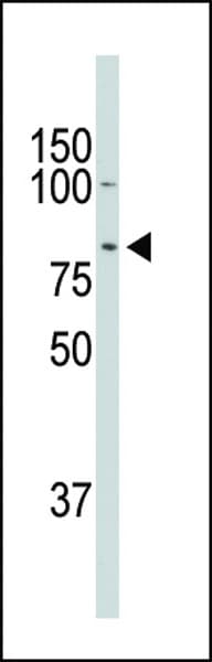 Polyclonal Rabbit anti-Human DCLK / DCLK1 Antibody (aa690-720, WB)