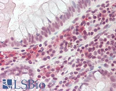 IHC-plus™ FBL / FIB / Fibrillarin Antibody (aa105-135)