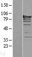 ASCC2 Protein (Over-Expression Lysate Myc-DDK (Flag))
