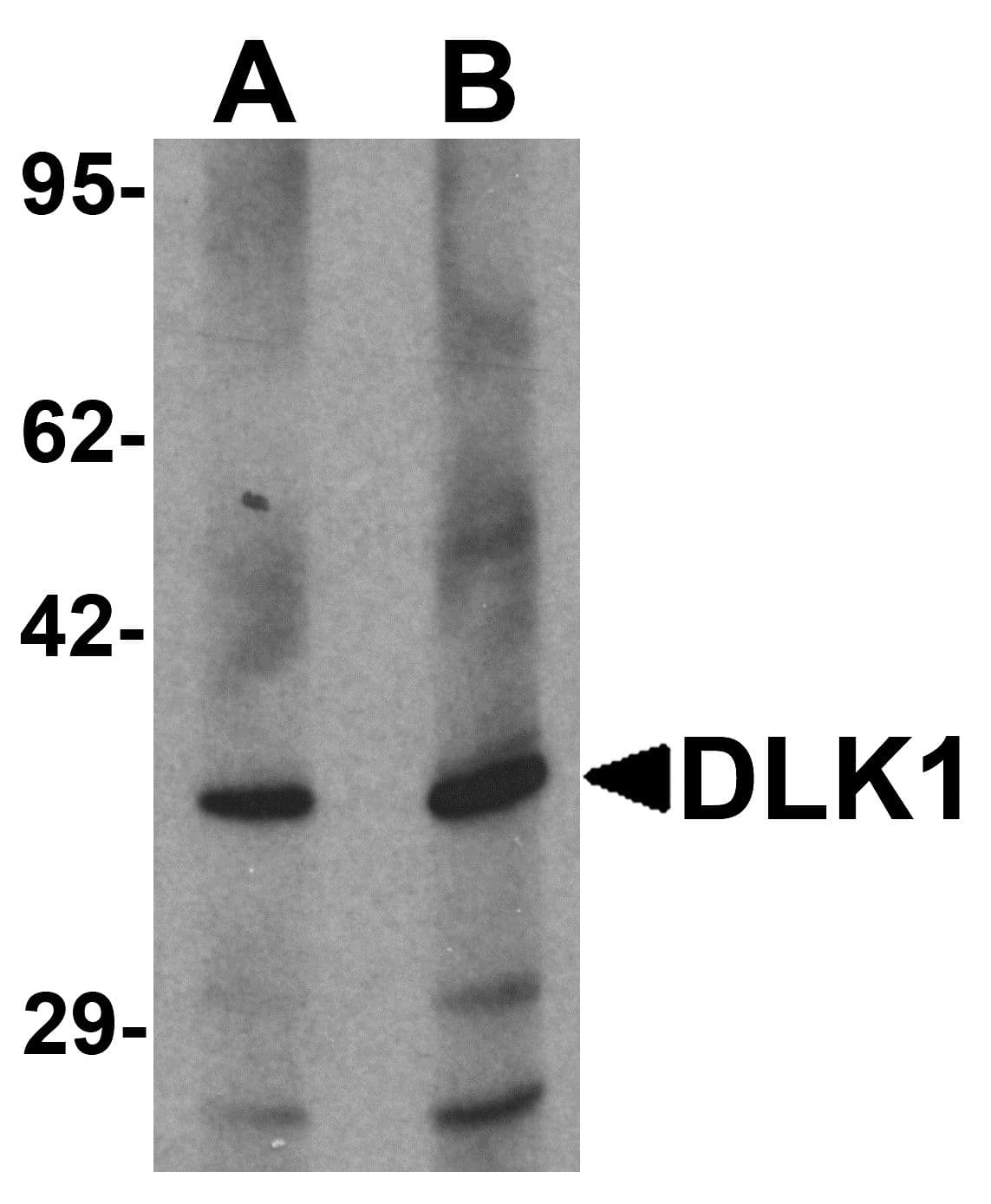 DLK1 / Pref-1 Antibody