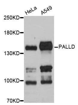 Polyclonal Rabbit anti-Human PALLD / Palladin Antibody (WB)