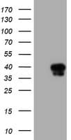 SERPINA5 / PCI Antibody (clone OTI2H10)