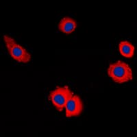 MUC16 / CA125 Antibody (Internal)