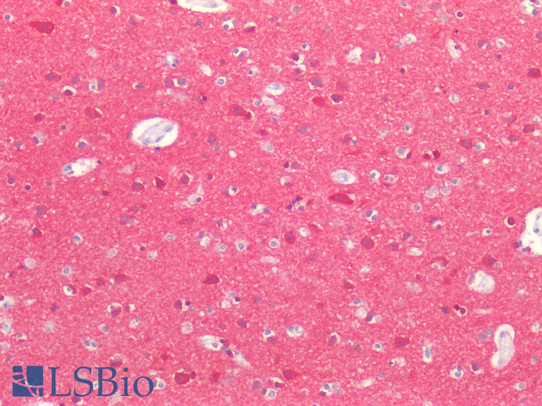 IHC-plus™ MAPT / Tau Antibody (phospho-S721)