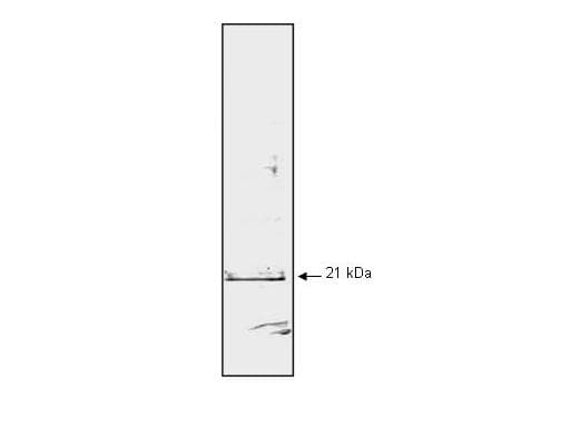 CDKN1A / WAF1 / p21 Antibody (clone WA-1)