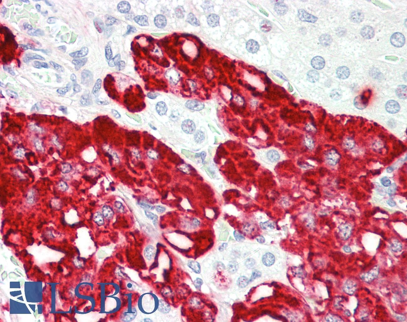 IHC-plus™ TCTEX1D1 Antibody