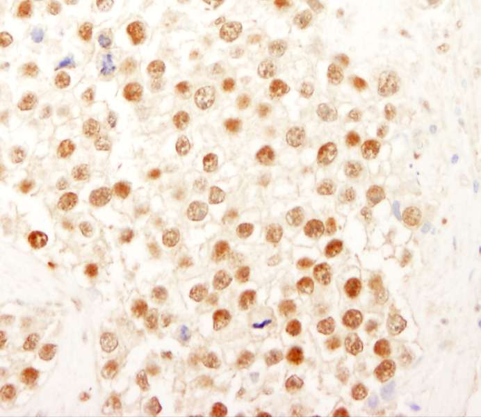 Polyclonal Rabbit anti-Human NFYC Antibody (aa408-458, IHC)