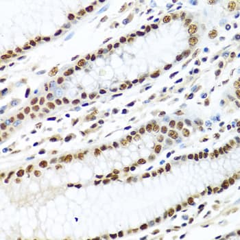Polyclonal Rabbit anti-Human METTL3 Antibody (IHC, WB)