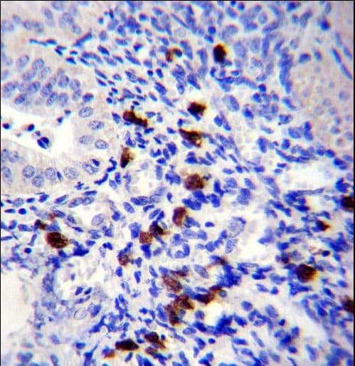 TNN / Tenascin N Antibody (aa587-615)