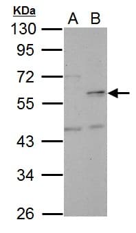Polyclonal Rabbit anti-Human CDCA1 / NUF2 Antibody (WB)