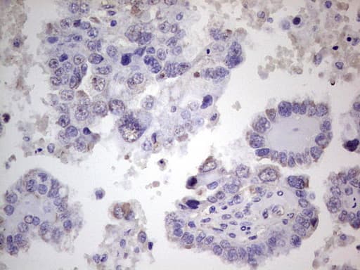 PROCR / EPCR Antibody (aa1-210, clone OTI13E1)