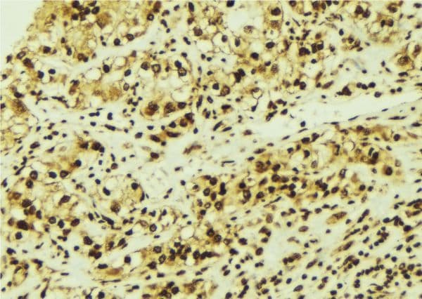 CDK6 Antibody