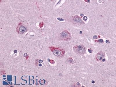 PathPlus™ TAAR1 / TA1 Antibody (Extracellular Domain)