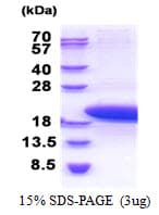 Human PTMS / Parathymosin Protein (Recombinant His)