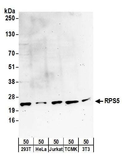 IHC-plus™ Polyclonal Rabbit anti-Human EDC3 Antibody (aa25-75, IHC, WB)