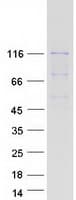 Human GARNL3 Protein (Recombinant Myc-DDK (Flag))
