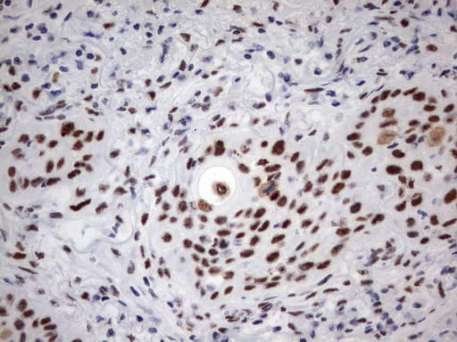 PARN Antibody (aa1-266, clone UMAB143)