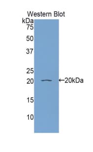 RBP5 Antibody (aa2-135, Biotin)