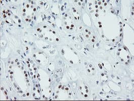 Monoclonal Mouse anti-Human SENP2 Antibody (clone OTI1H2, IHC, IF, WB)