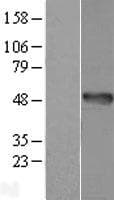 AMDHD1 Protein (Over-Expression Lysate Myc-DDK (Flag))