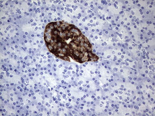 ADAMTS1 Antibody (aa412-644, clone OTI4E3, Carrier-free)