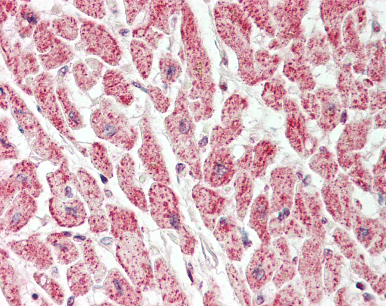 Polyclonal Rabbit anti-Human VAC14 / TRX Antibody (aa711-760, IHC, WB)